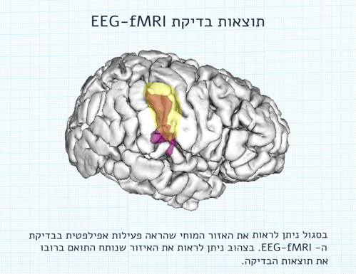 EEG_FMRI2